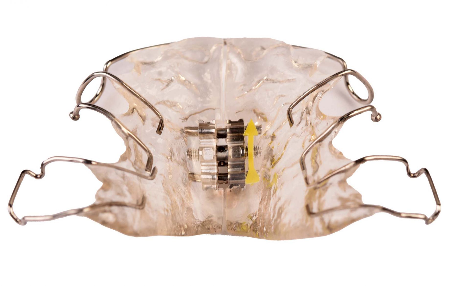 Digital Dental Laboratory in Dubai Qualident Lab